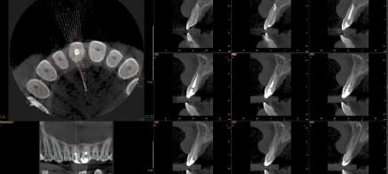 3D Xray Scanning