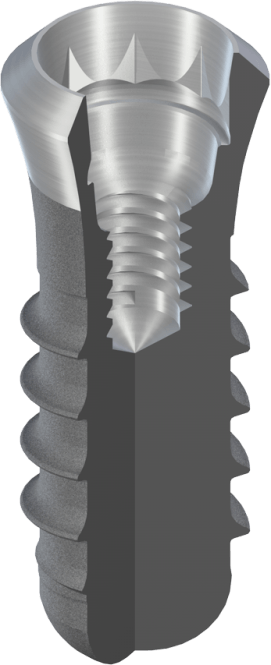 Dental Implant section through